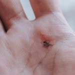 Virus Zika: Segala yang Perlu Diketahui tentang Ancaman Global ini!